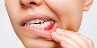 Mouth Care