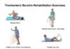 Trochanteric Bursitis Exercises for Pain Relief Trochanteric Bursitis Exercises for Pain Relief