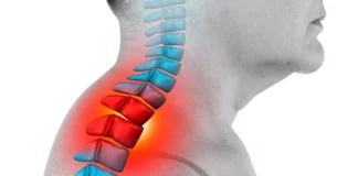 Neck Hump Exercises to Improve Posture Naturally