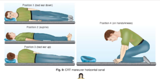Vestibular Exercises for Better Coordination and Focus Vestibular Exercises for Better Coordination and Focus