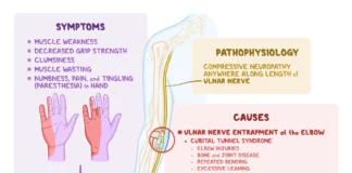 Ulnar Nerve Entrapment Exercises to Improve Arm and Hand